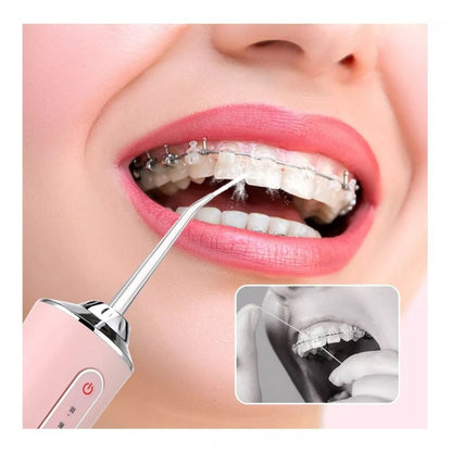 Irrigador Oral Recargable | Elimina Sarro y Placa – 4 Boquillas Incluidas – Limpieza Profesional